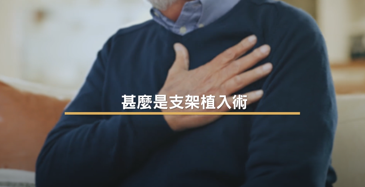 [醫生講場] 通波仔（下）– 支架植入術 (鄭裕康醫生)